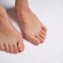 Toe Spacers for Bunions: A Non-Surgical Way to Ease Foot Pain